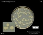 pseudomonas aeruginosa colonies on agar